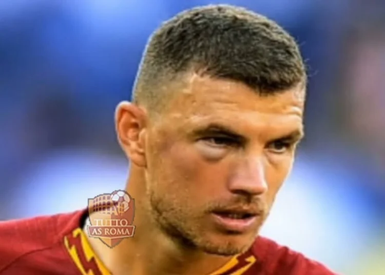 Dzeko Fazzia tumefatta Roma-Cagliari - Photo by Getty Images