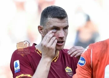 Dzeko Faccia tumefatta Roma-Cagliari - Photo by Getty Images