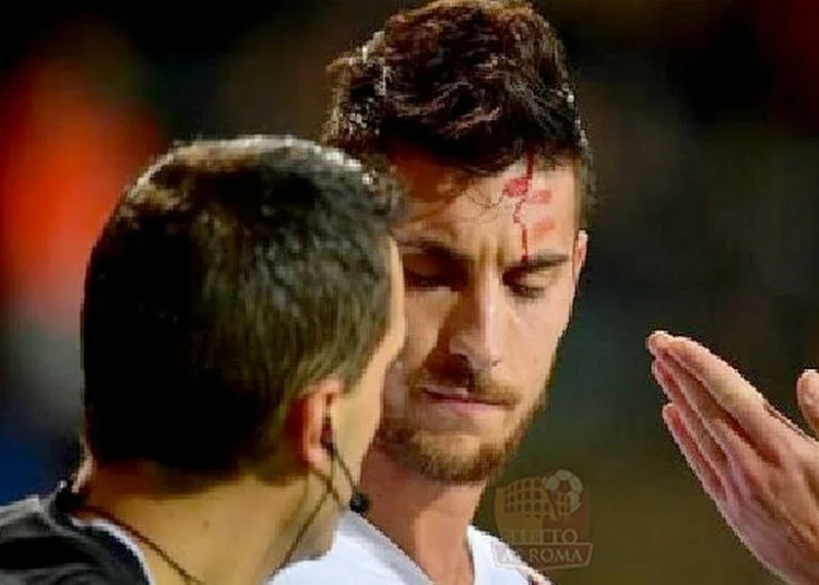 Lorenzo Pellegrini sanguinante dopo essere stato colpito da un accendino lanciato dalle tribune Basaksehir-Roma - Photo by GettY iMAGES